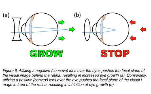 reverse myopia 